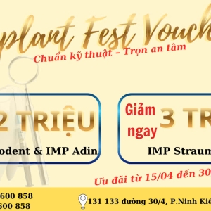 uu-dai-2-trieu-den-3-trieu-dong-tru-implant-dip-le-304-va-15-nam-2026
